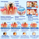 Adesivo Reparador Oral Dente + Gengivas