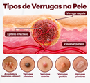 Dual-Action® Bálsamo anti Manchas e Verrugas 2 em 1